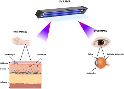 Uv Lamp Failure Reasons