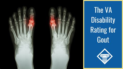 va gout disability rating