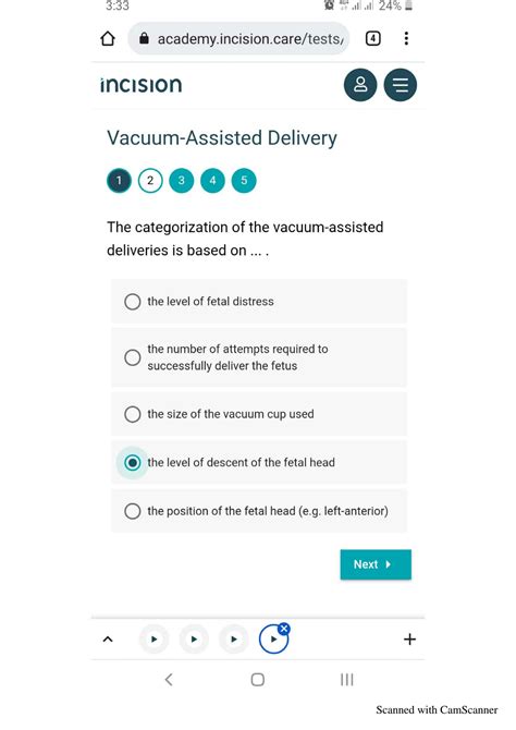 Vacuum Delivery Icd 10