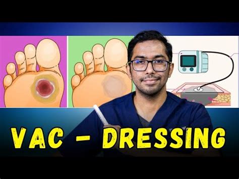 Vacuum Dressing Side Effects