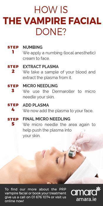 vampire facial procedure steps