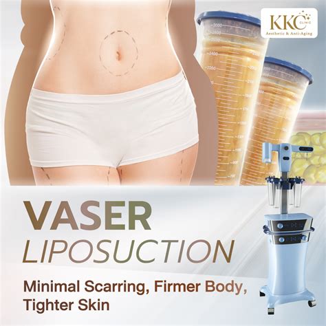 Vaser Liposuction Qatar