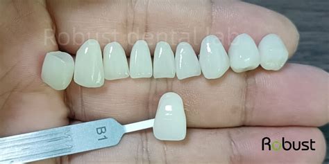 Veneers Teeth Stumps