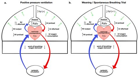 Ventilator Heart Meaning