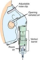 Venturi Mask Definition