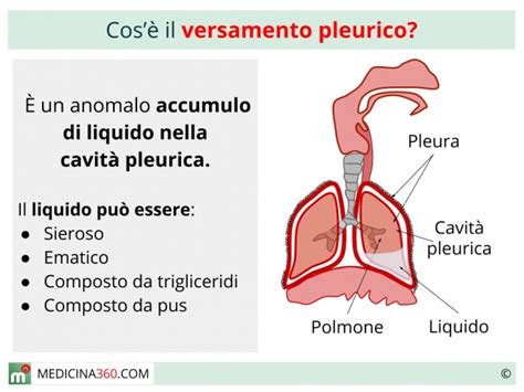 versamento pleurico cause e sintomi