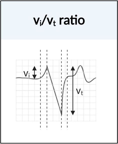 Vi Vt Ratio