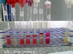 vibrio cholerae biochemical test