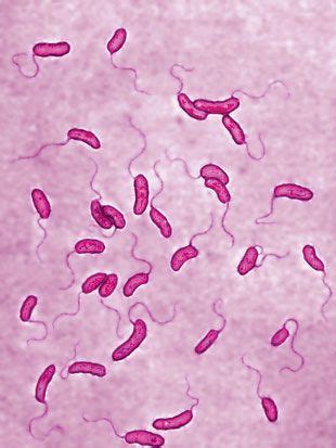 vibrio cholerae gram positive or negative