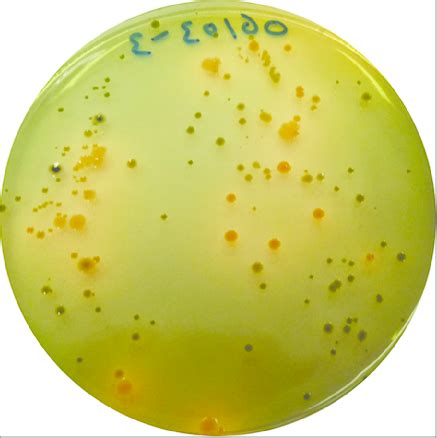 vibrio cholerae green tcbs