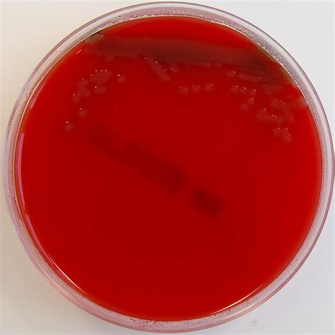 vibrio cholerae growth on blood agar