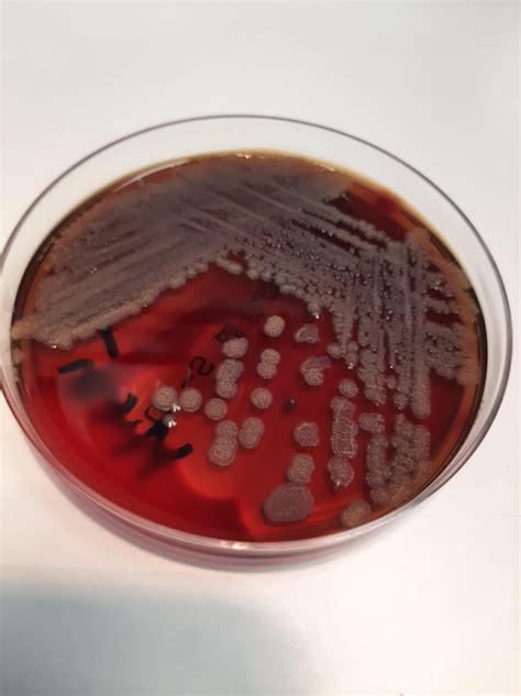 vibrio cholerae on blood agar