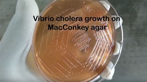 vibrio cholerae on macconkey agar