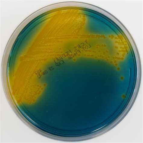 vibrio cholerae on tcbs agar