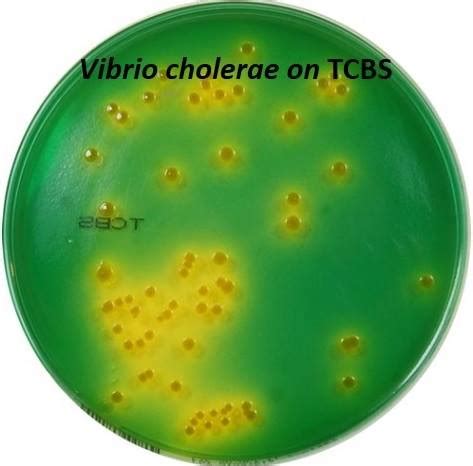 vibrio cholerae pada media tcbs