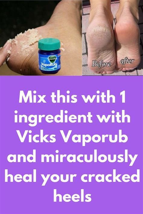 vicks cracked heels