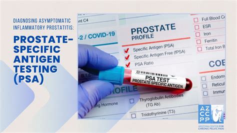 victimization Open informant RMM prostate specific antigen in your brass