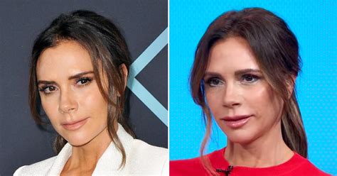 victoria beckham lip filler