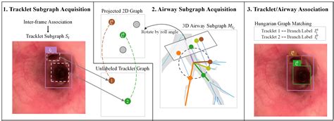 vide airway tracking