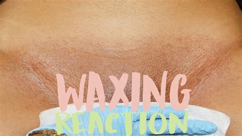 video of a brazilian wax