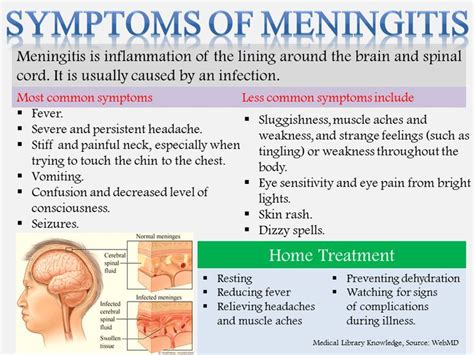 viral meningitis treatment nhs