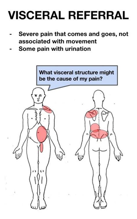 Pain Referred Pictures