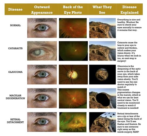 Vision Disorders List