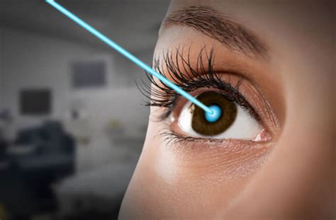 vision insurance lasik+modes