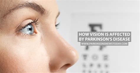 vision problems and parkinson's disease