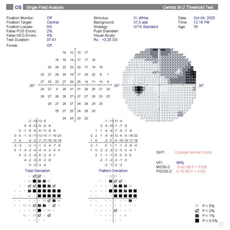 Visual Field Extended Vs Intermediate