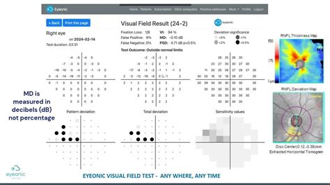visual field test online