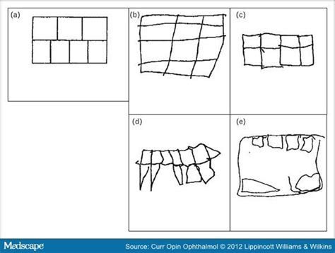 Visual-Spatial Deficits In The Classroom