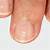 vita fläckar på naglarna