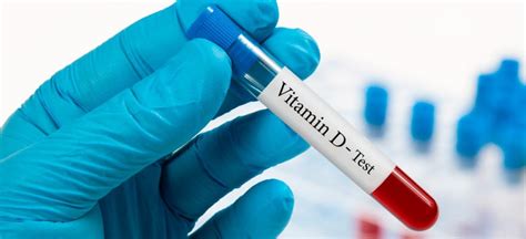 vitamin d 25 hydroxy test tube
