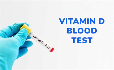 vitamin d blood test fasting