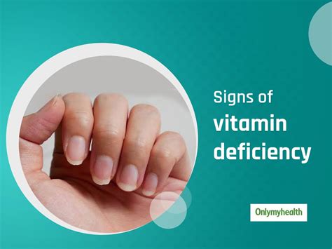 vitamin d deficiency skin problems