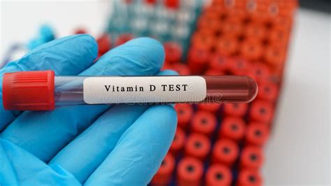 vitamin d lab testing
