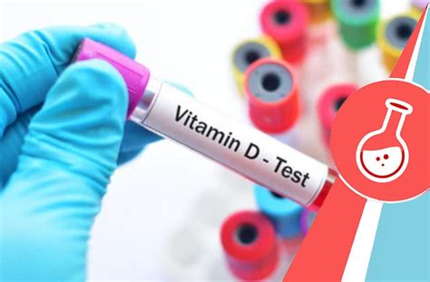 vitamin d test cost nz