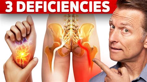 Vitamin Deficiency Causing Sciatica