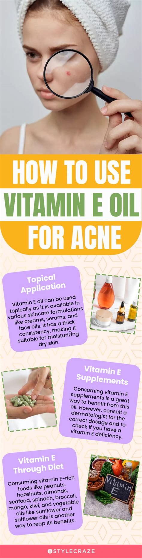 Vitamin E Help Acne