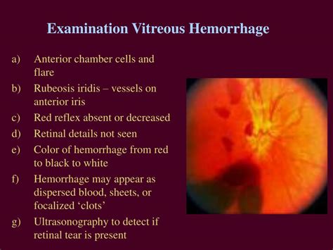 vitreous haemorrhage referral urgency