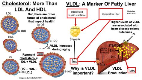 vldl cholesterol cal high means