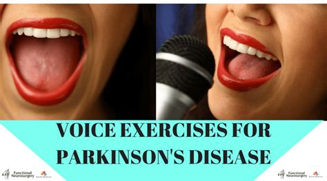 vocal exercises for parkinson's patients