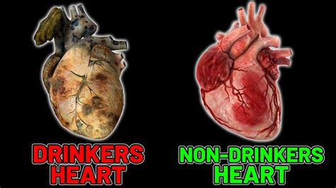 Vodka Effects On Heart