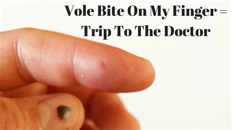 Vole Do They Bite