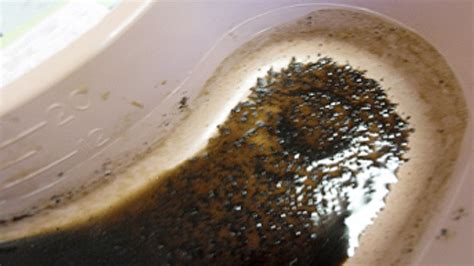 Vomit Coffee Grounds Headache
