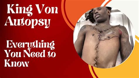 vons autopsy