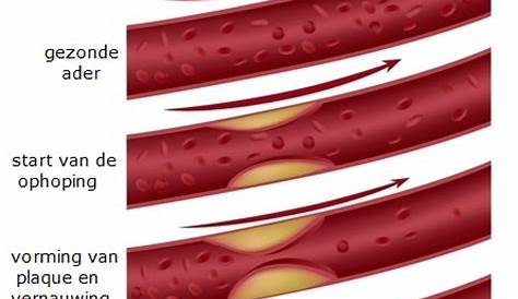 Bloedvaten: slagaderen, aderen en haarvaten | Mens en Gezondheid: Diversen