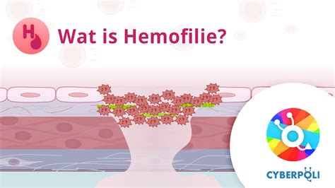 wat is er aan de hand bij hemofilie