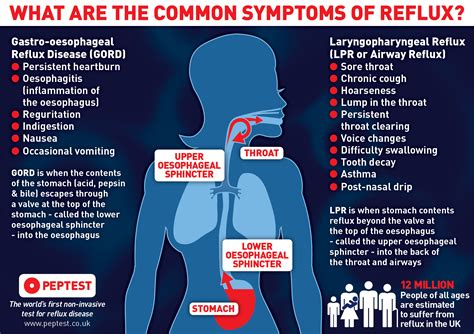 wat is reflux oesophagitis